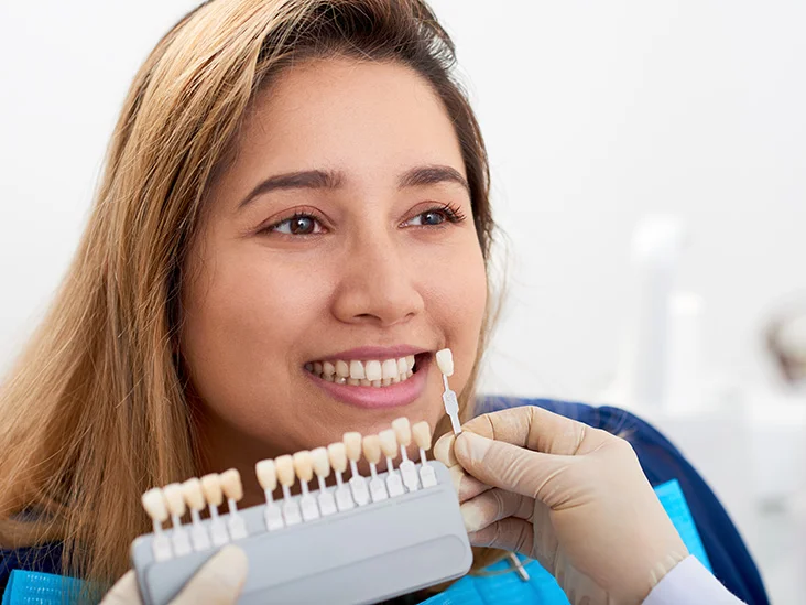 Person with long hair wearing a blue dental bib in a dental office. A gloved hand is holding a shade guide with various tooth shades in front of the person's mouth for color matching.