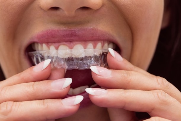 Invisalign in Long Beach